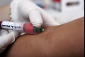 Krvný test Galleri dokáže odhaliť niektoré druhy rakoviny