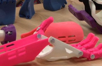VIDEO: Malé dievčatko dostalo protézu ruky vyrobenú technológiou 3D